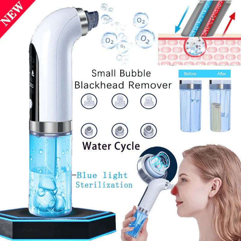 Blackhead Remover Vacuum – Water Cycle Pore Cleaner